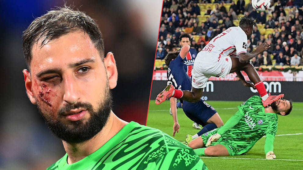 Brutal vom Platz getreten Horror-Verletzung bei PSG-Torwart Donnarumma