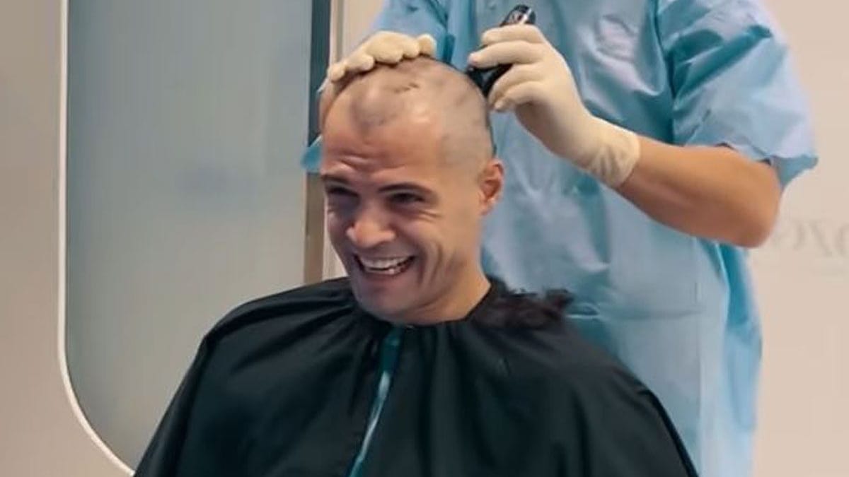 Granit Xhaka: The Bayer Leverkusen star had hair implanted.