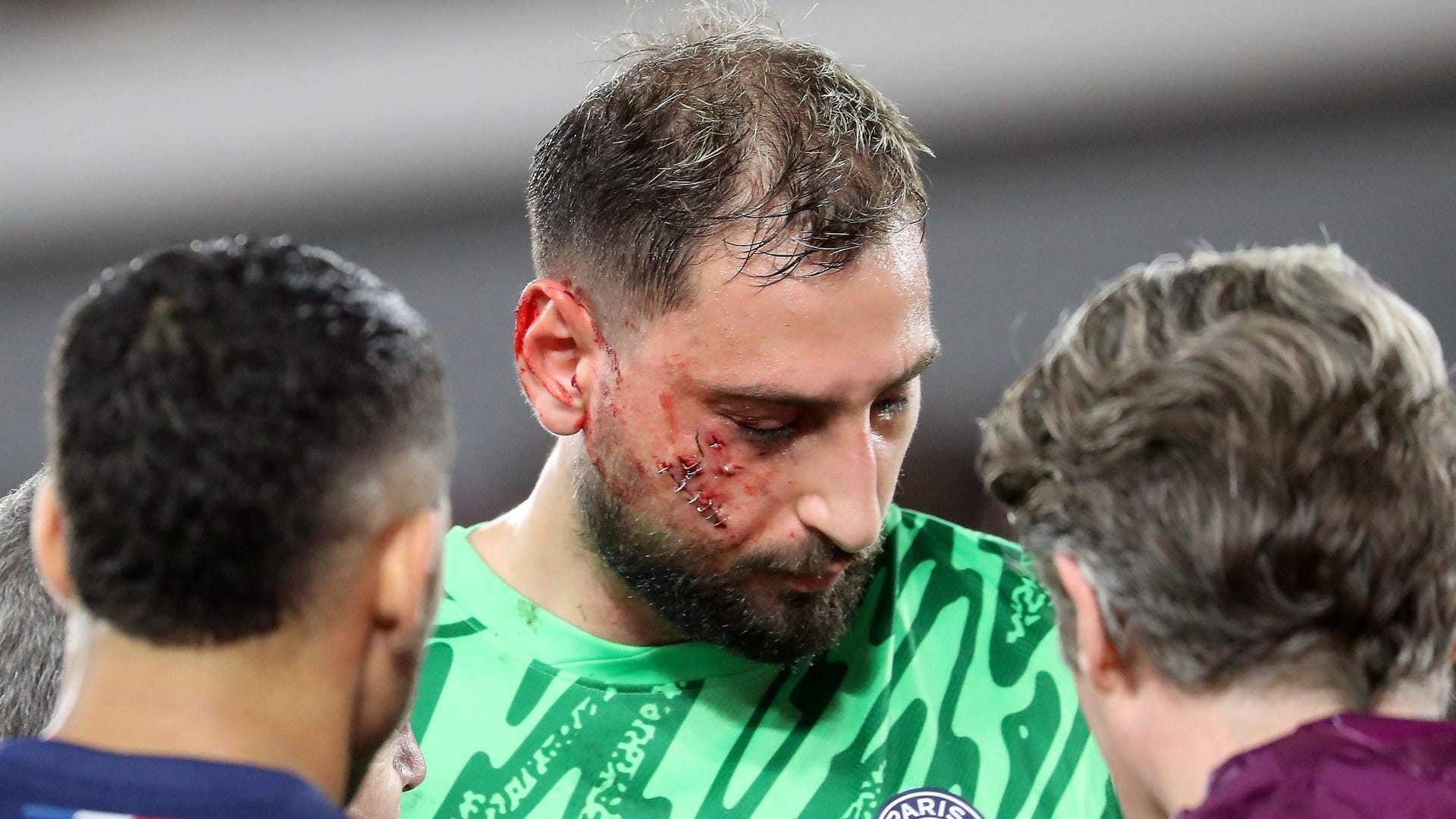 Gianluigi Donnarumma (center): He got a nasty kick in the face.