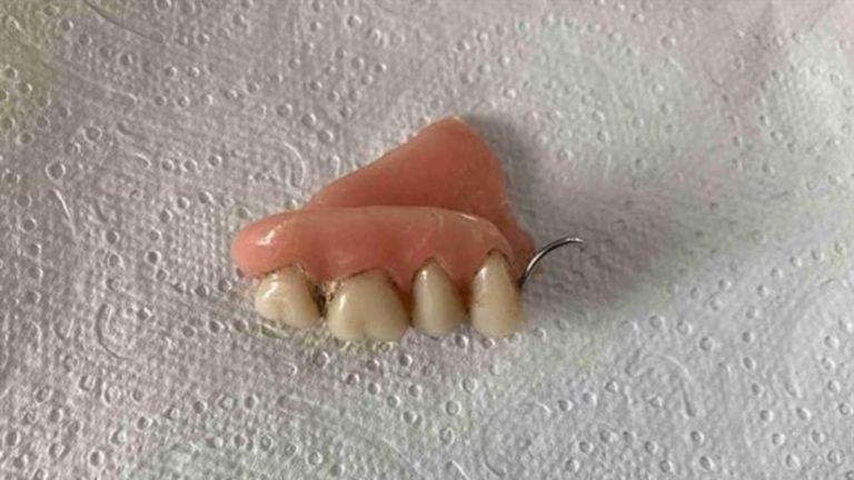 Found teeth in Rosmalen. 