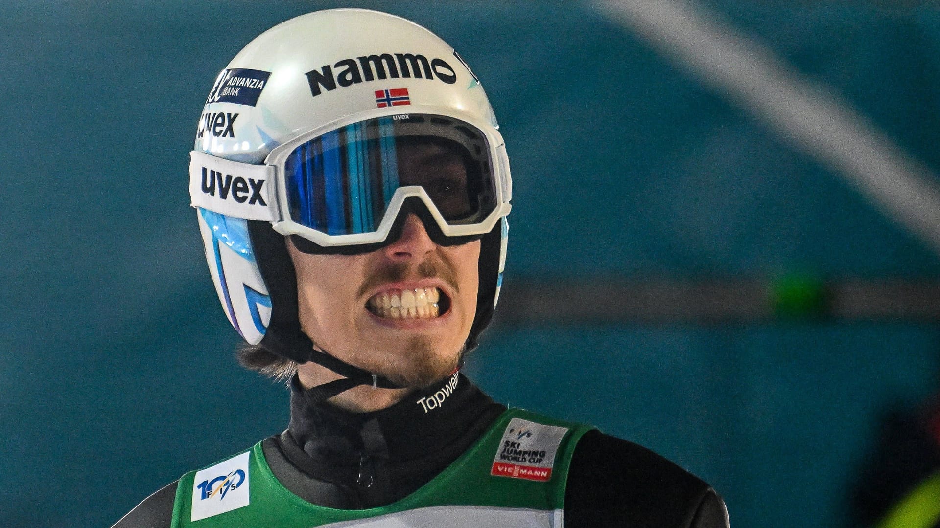 Johann André Forfang: The Norwegian suffers from back pain.