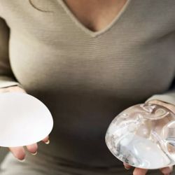 Breast implants | Photo: CEDOC