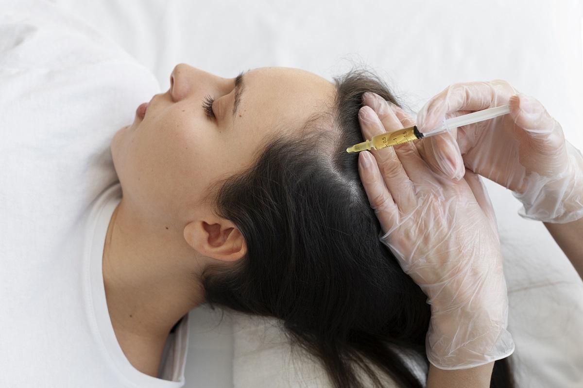Existen múltiples tratamientos para tratar la alopecia androgénica femenina.
