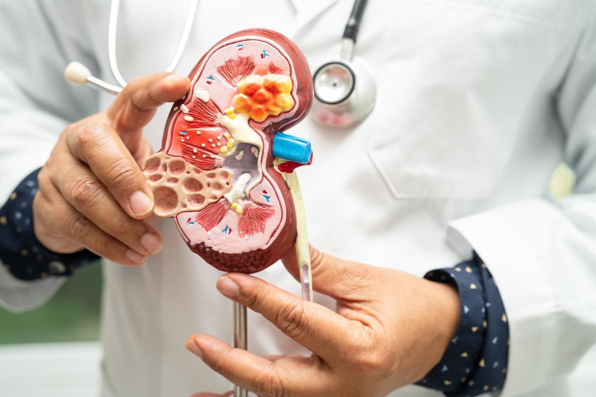 Cómo detectar a tiempo la enfermedad renal crónica