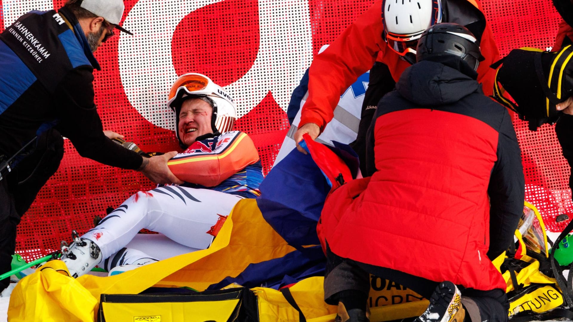 Jacob Schramm: The German ski racer has torn both cross bands. Jacob Schramm: The German ski racer has torn both cross bands.