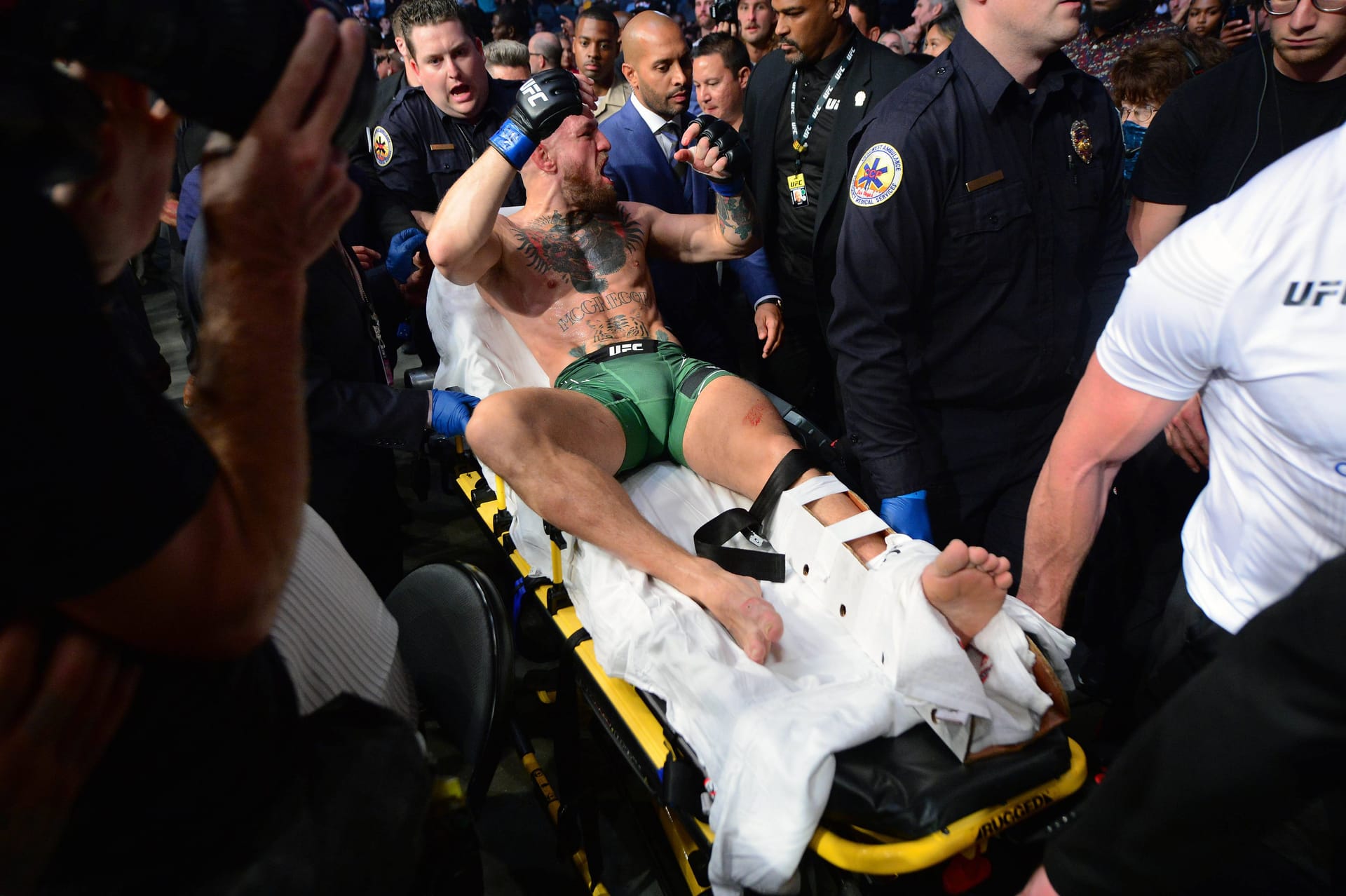 Conor McGregor is transported away on a stretcher: in his last UFC fight so far, he broke his leg.
