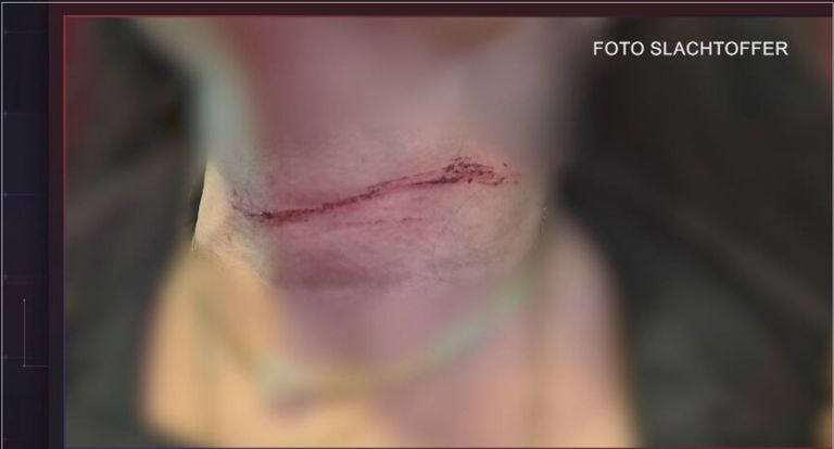 The injury that the woman left with her abuse (photo: victim/agency Brabant).