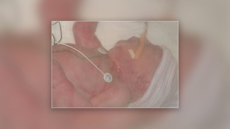 Thijn shortly after his birth (private photo).