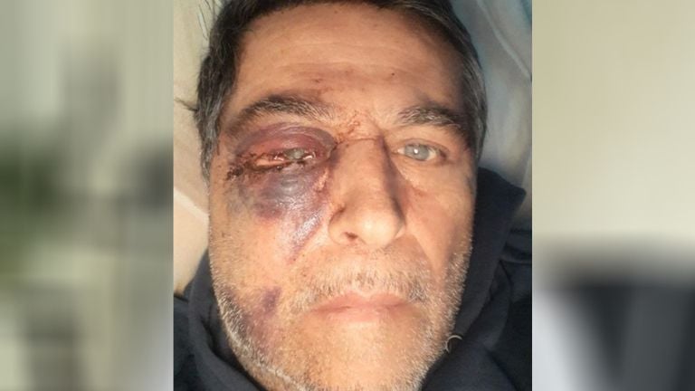 Ercan shortly after the mistreatment (private photo).