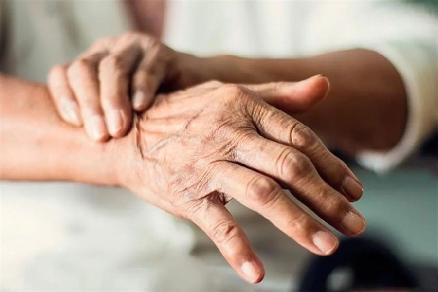 Parkinson