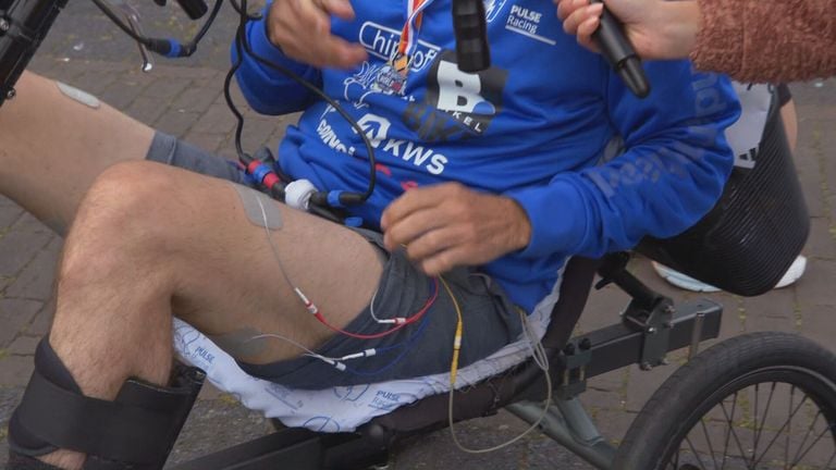 Electrodes on Peter's legs (photo: Omroep Brabant).