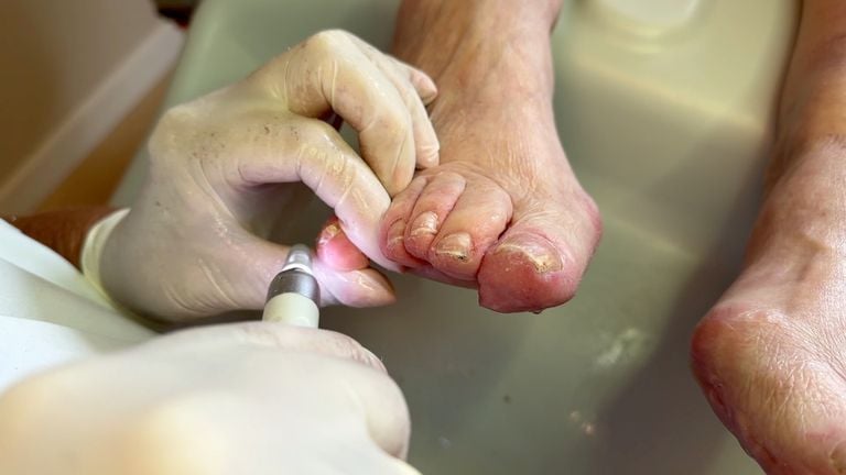Pedicure Mimi treats the foot of customer Netty (photo: Ronald Sträter).