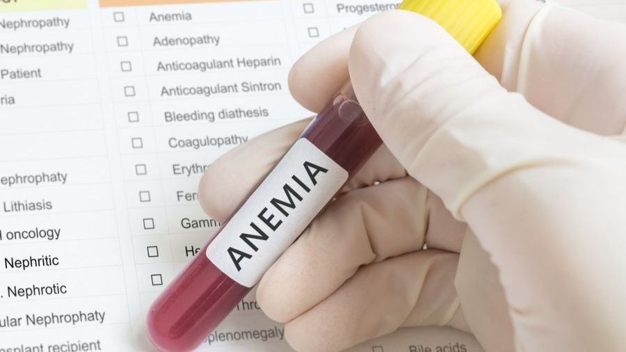 Anemia