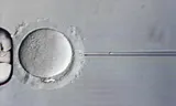 A genetic test at the embryo increases the chance of a healthy child.