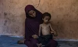 Two-year-old Yazan Abu Foul is on his mother's lap, near Gaza Stad. He is seriously malnourished by the ongoing Israeli blockade of relief supplies. Photo Haitham Imad/EPA 