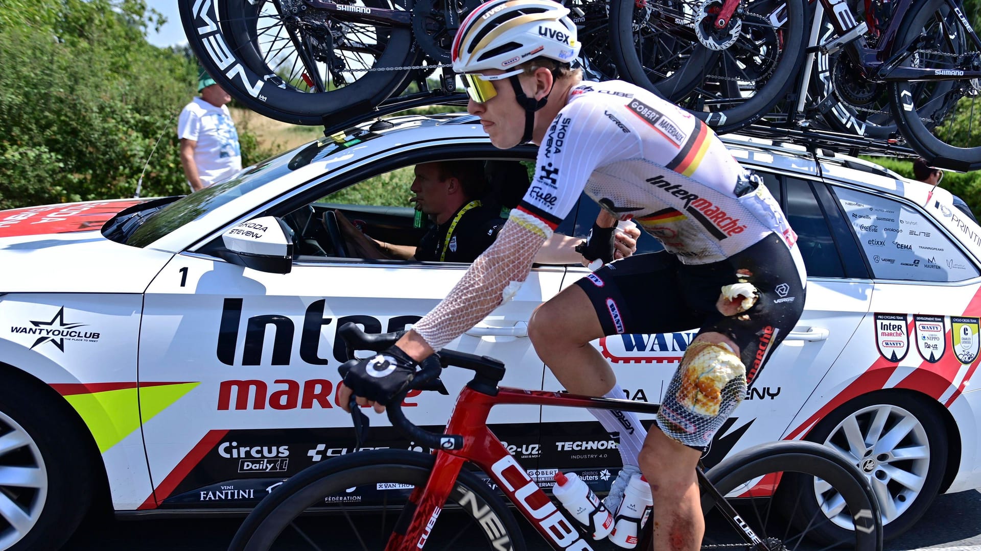 Georg Zimmermann with his wounds: The German cyclist crashed on Sunday.