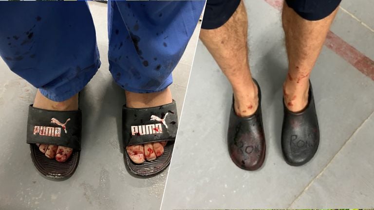 Rons operating clogs have just arrived Gaza, before that he borrowed slippers, 'unimaginable in the Netherlands' (private photo).