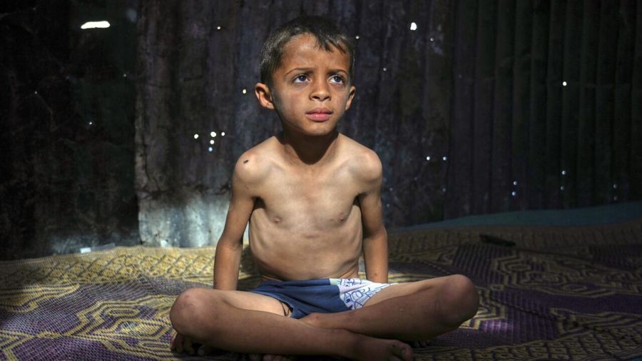 Hunger in Gaza