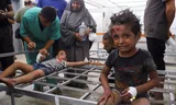 Wounded Palestinian children are being treated at Al-Shifa Hospital in Gaza City after being injured in an Israeli attack, medics said. 