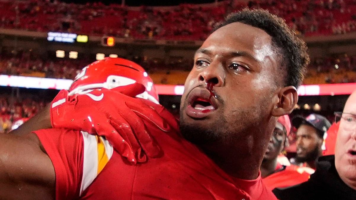 Juju Smith-Schuster with a bloody nose: He was attacked after the game.