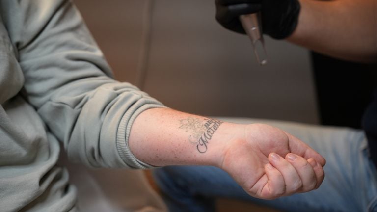Welding away a tattoo is not as easy as it may seem here (photo: Rochelle Moes).