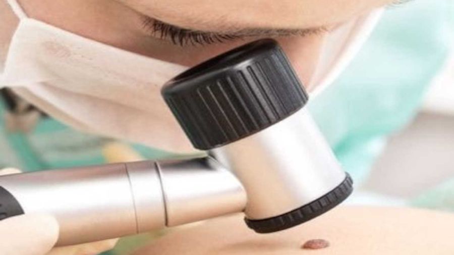 Skin cancer 20250520