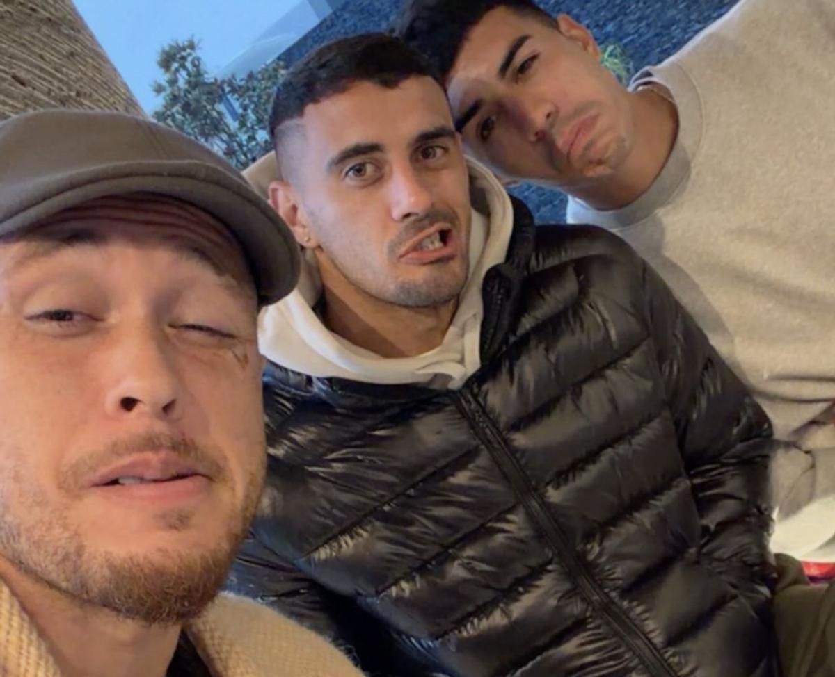 Ocampos takes his facial injury with humor