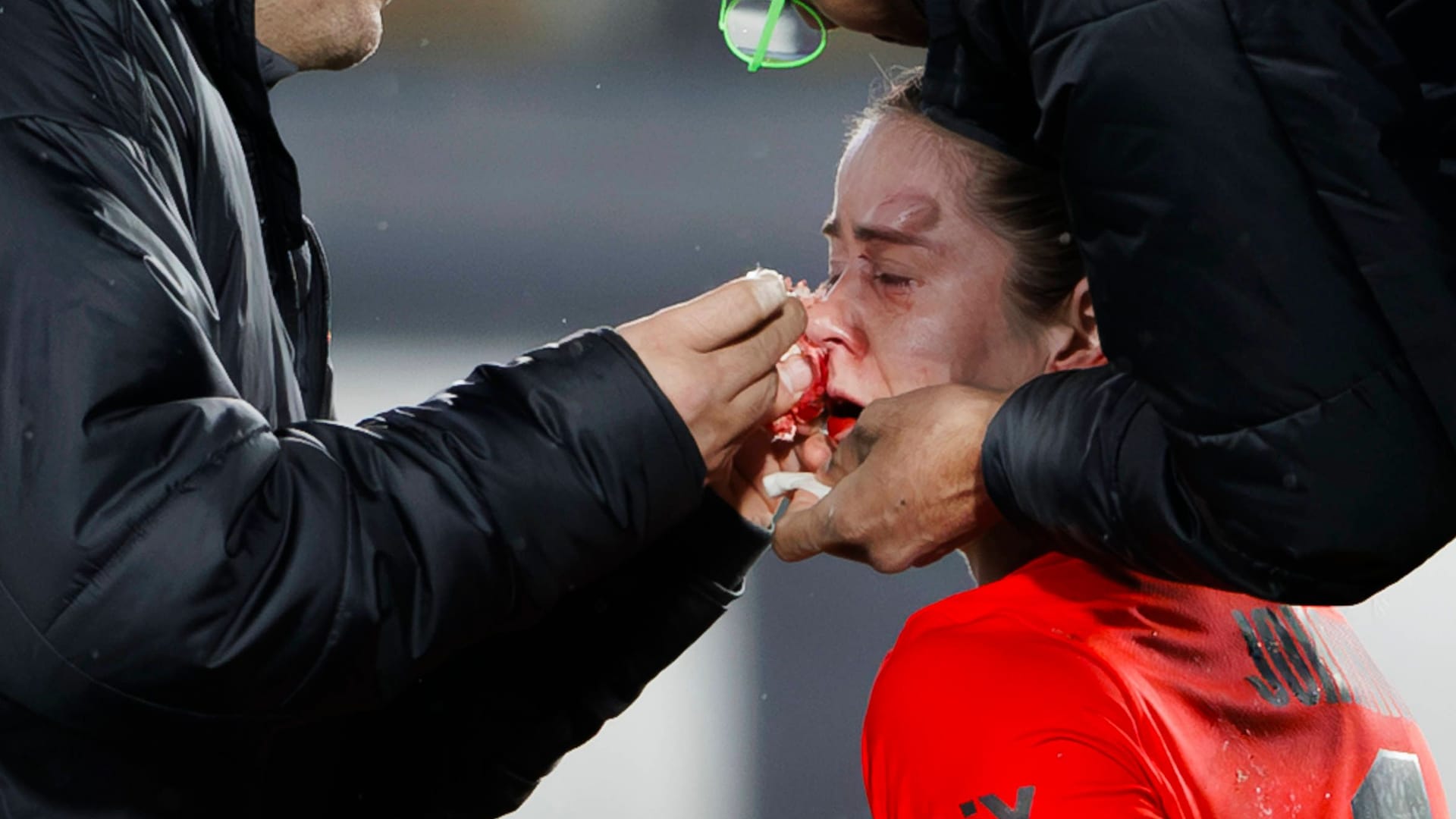 Stina Johannes is being treated: she was hit hard by an opponent.