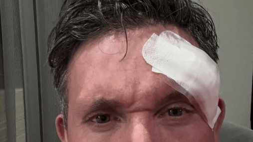 Robbie Fowler: The Englishman had to undergo facial surgery.