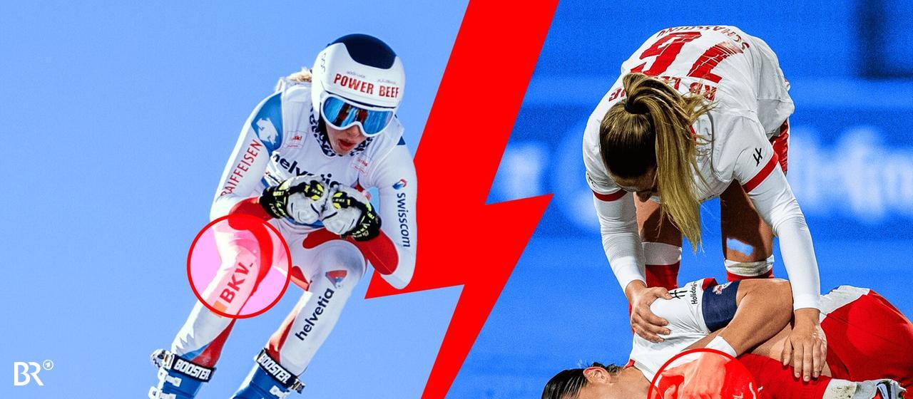 Report: Who will stop cruciate ligament tears?