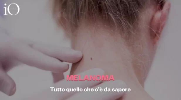 Melanoma: why the mRNA vaccine halves the risk of recurrence – iO Donna