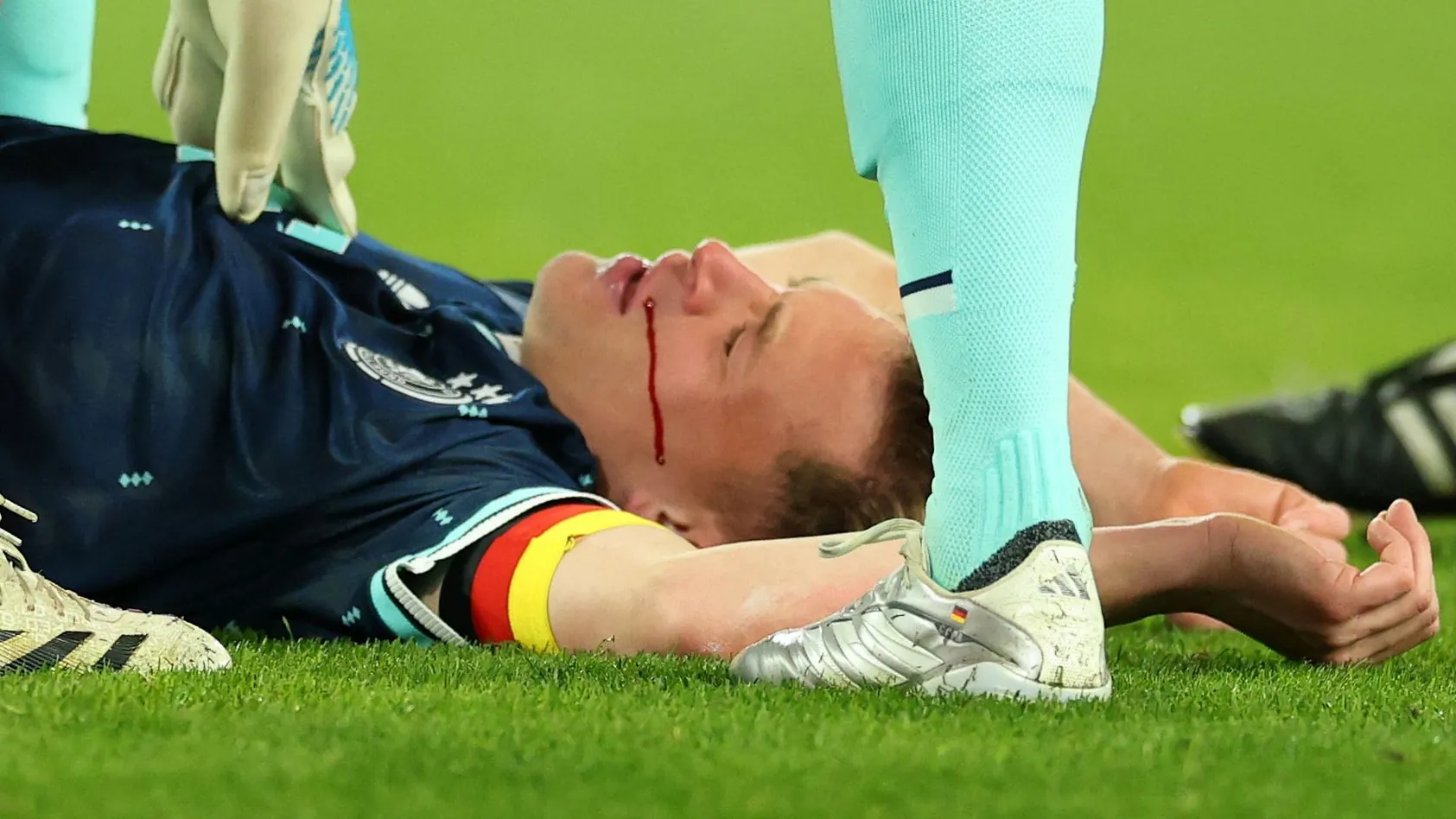 On the ground: Joshua Kimmich is lying on the grass in the game against Switzerland and is bleeding from his nose. On the ground: Joshua Kimmich is lying on the grass in the game against Switzerland and is bleeding from his nose.