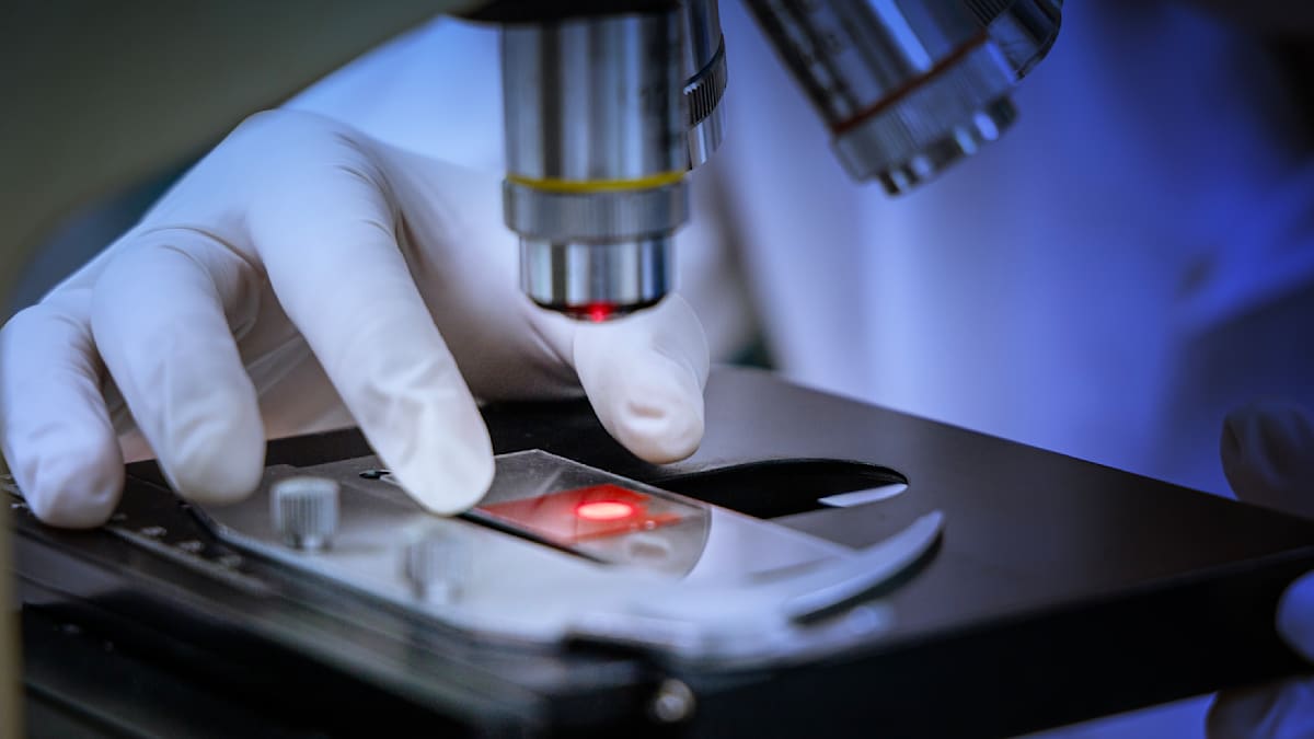 Breakthrough: Cancer Diagnosis Cut from 12 Days to Just 12 Minutes!