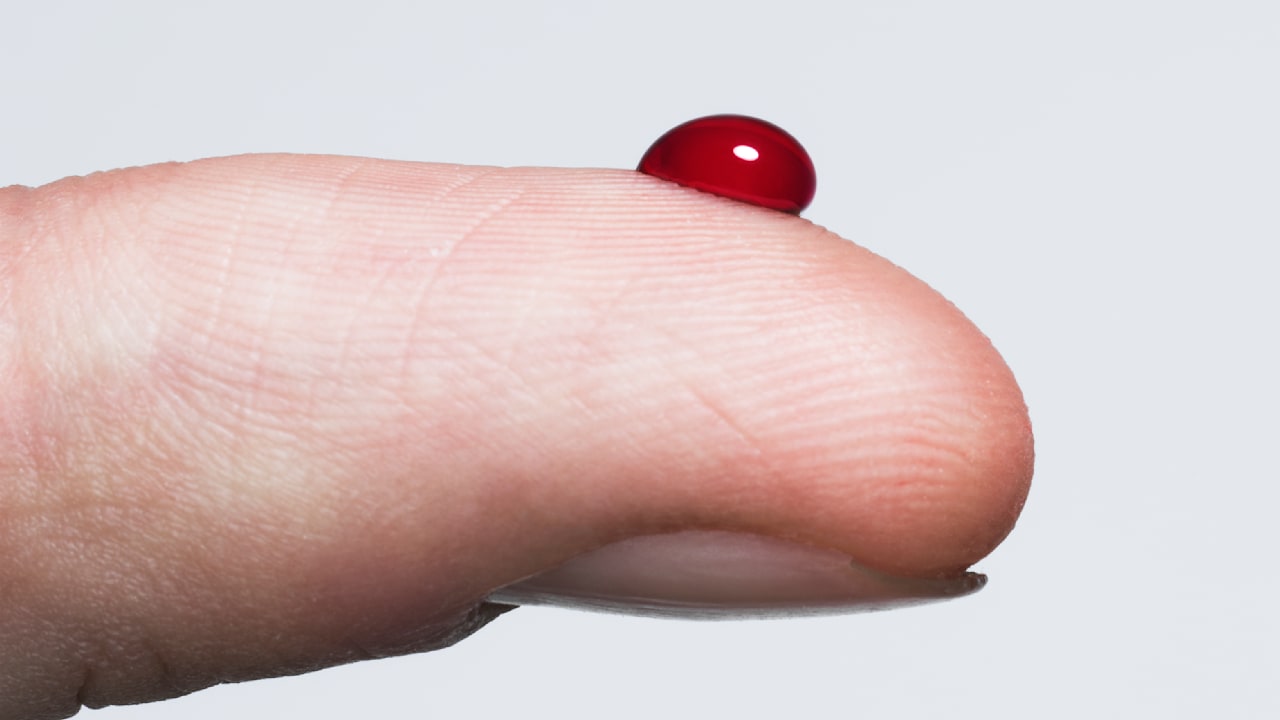 Experts Warn: The Risks of New Alzheimer Blood Tests You Should Know