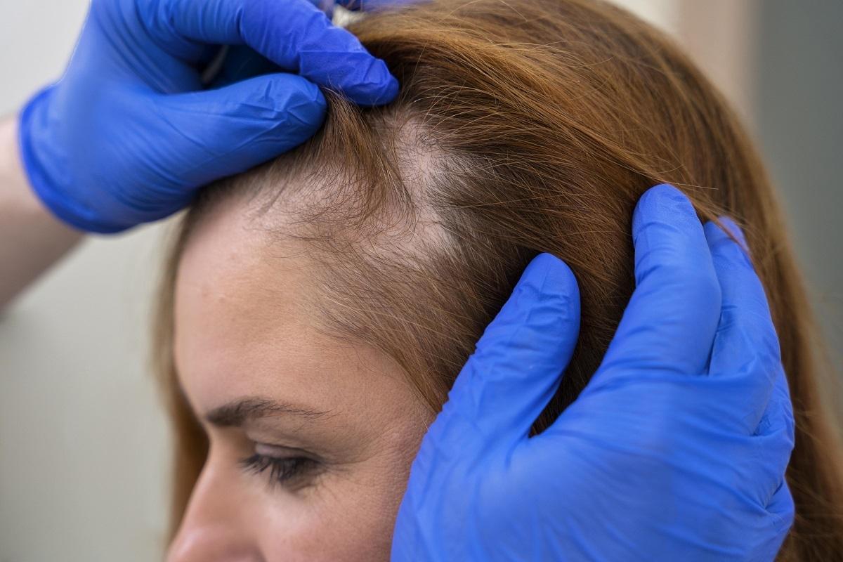 Marta León, hormone expert: “If you lose more hair every day, choline, biotin and checking your iron are essential”