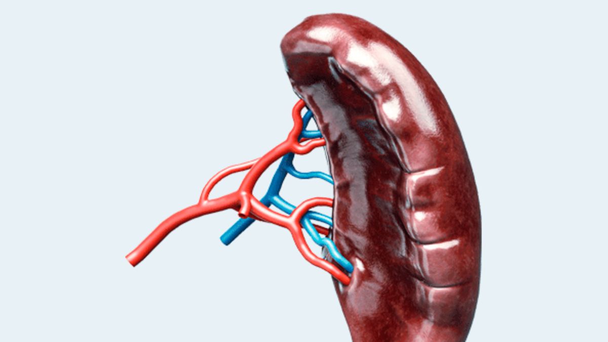 One in Ten Lupus Patients Develop Hyposplenism: What You Need to Know