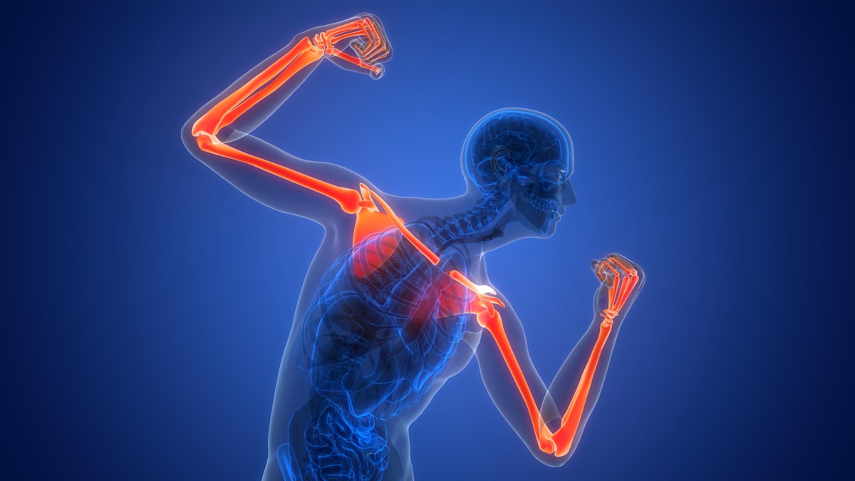 Osteoporosis Uncovered: How Bones Gradually Lose Strength Silently