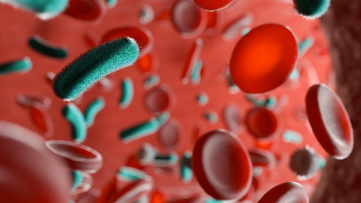 Recognize the Hidden Signs of Sepsis: Key Symptoms You Must Know