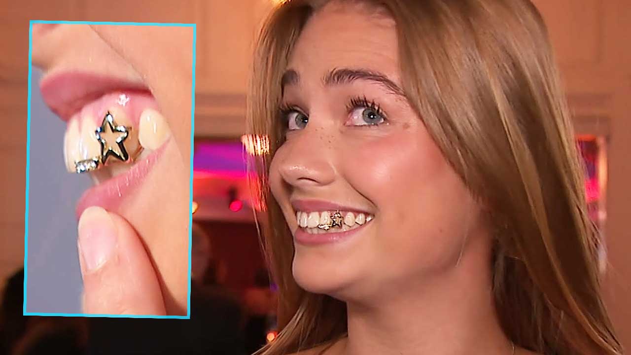 Roxy Dekker appears on TV with new teeth: ‘Yes, this is a grill’