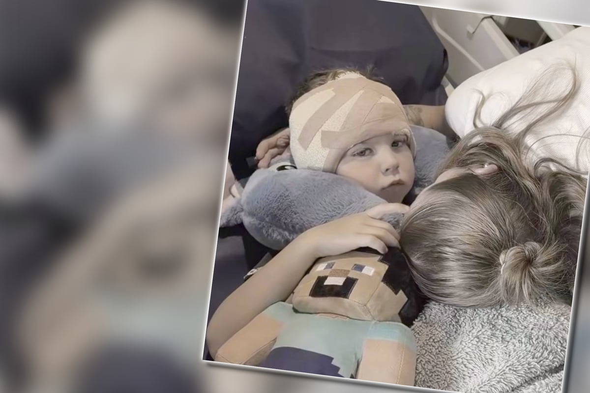 5-Year-Old Undergoes Surgery to Fix Prominent Ears – Now He Feels Great!