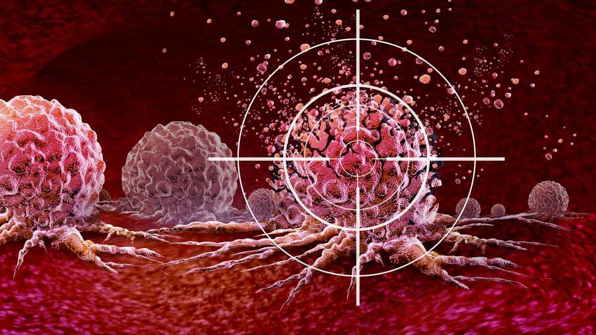 Breast, Prostate, Colorectal Cancer: Latest Breakthroughs in Treatment Options
