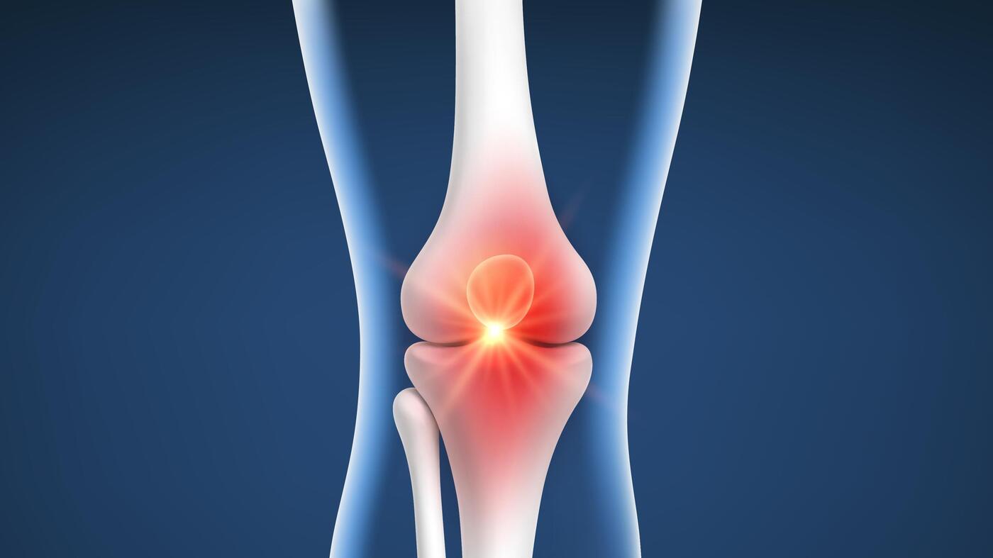 Can Osteoarthritis Be Cured? Stanford Researchers Rejuvenate Cartilage Cells!