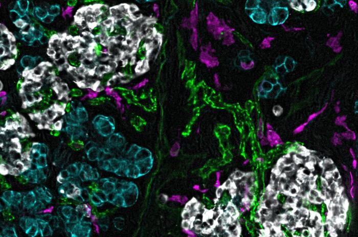 Childhood Pancreas Development: New Insights into Diabetes Risks