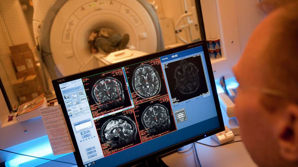 Could Two Gut Bacteria Be the Key Triggers of Multiple Sclerosis?