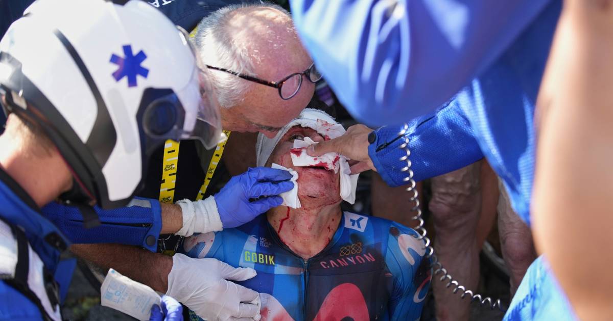 Cyclist’s Shocking Accident: Head Smashes Through Car Window at Tour!