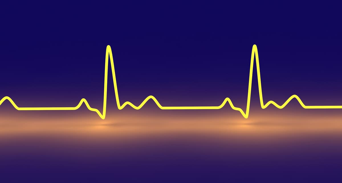 Dapagliflozin: Reducing Heart Failure Risk in Genetic Cardiomyopathy Patients
