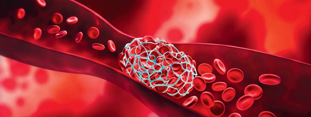 Direct Oral Anticoagulants vs. Phenprocoumon: Impact on Mortality and Complications