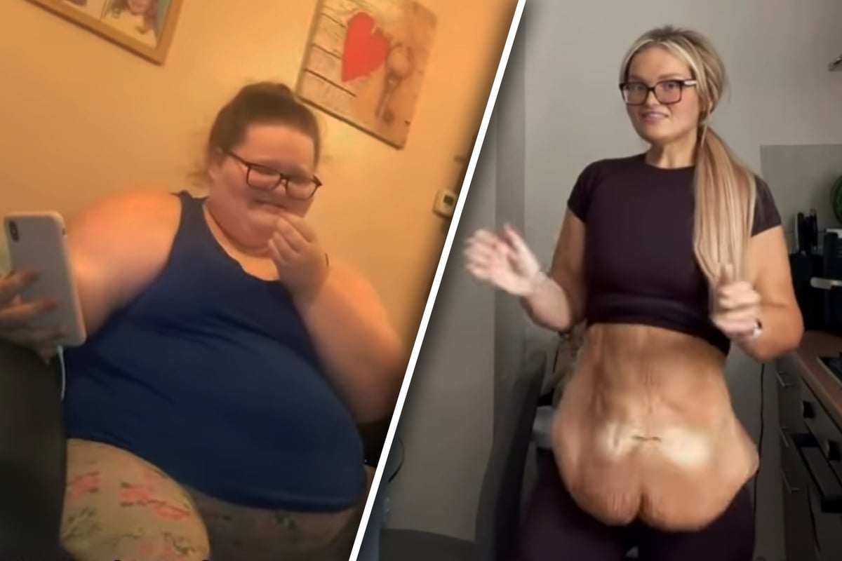 Doctors Warn 29-Year-Old Woman Weighing 235 kg She Won’t Live Past 30 – Her Remarkable Change!