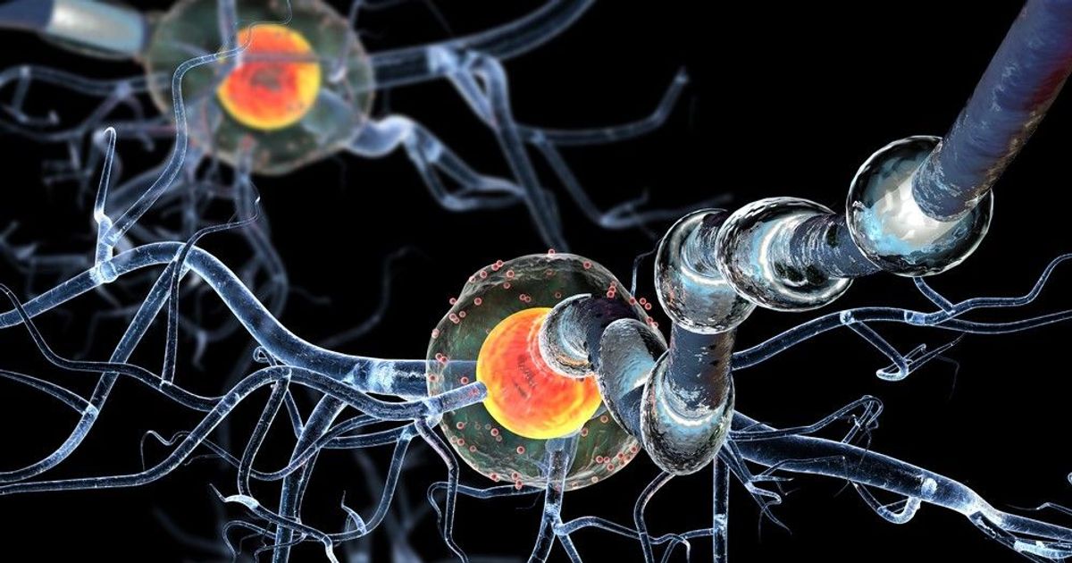 Expert Predicts Cure for Multiple Sclerosis Within a Decade: Hope for Patients