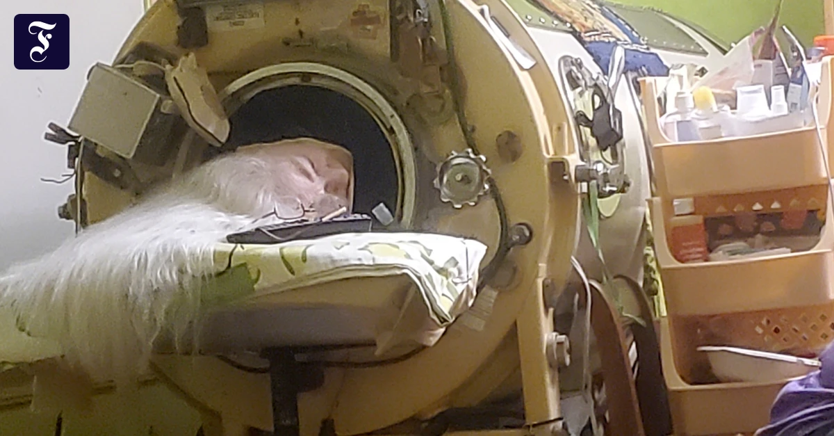 Final Chapter: Last Polio Survivor Who Used Iron Lung Dies at 78